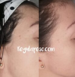 aclarante facial 1